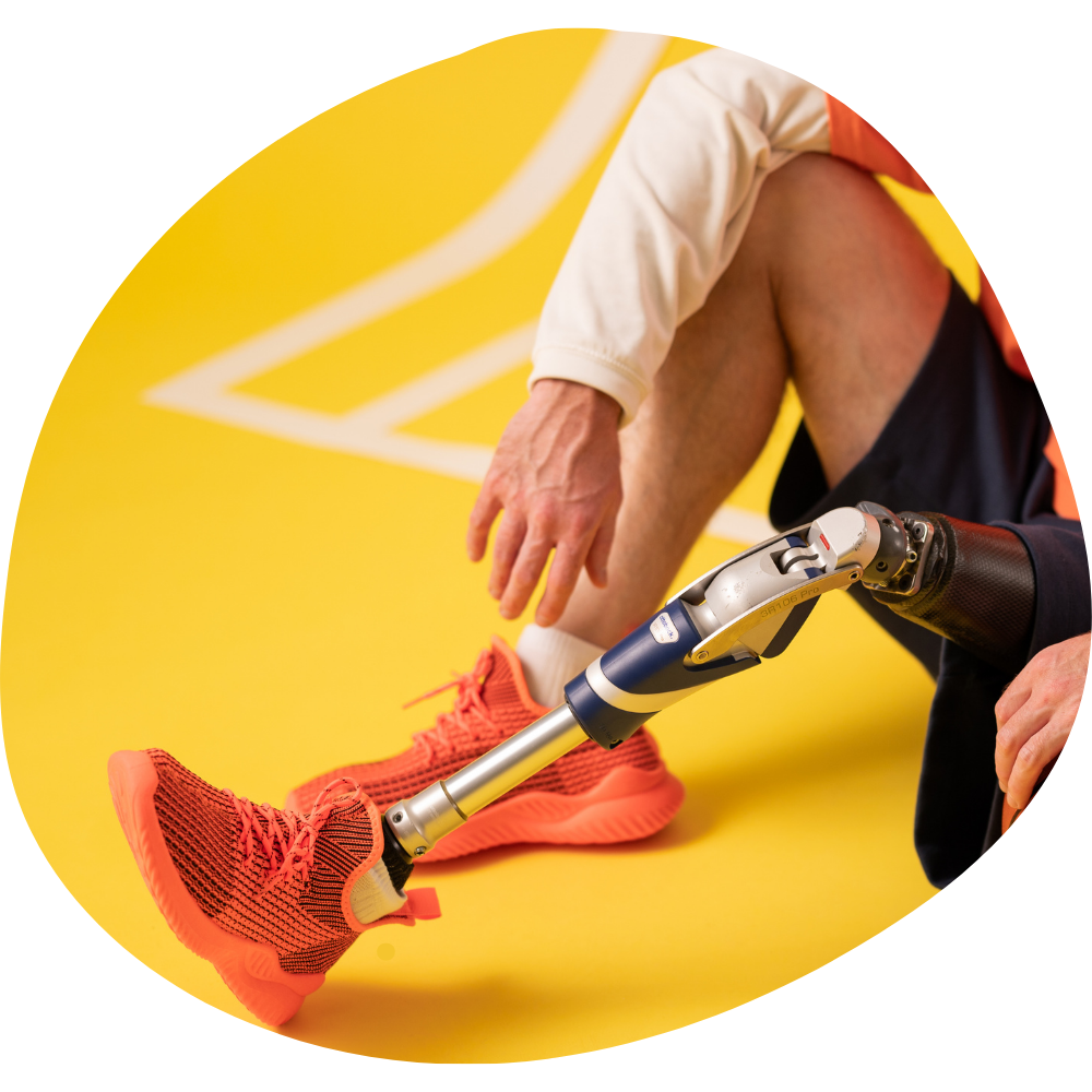 Customised Prosthetics